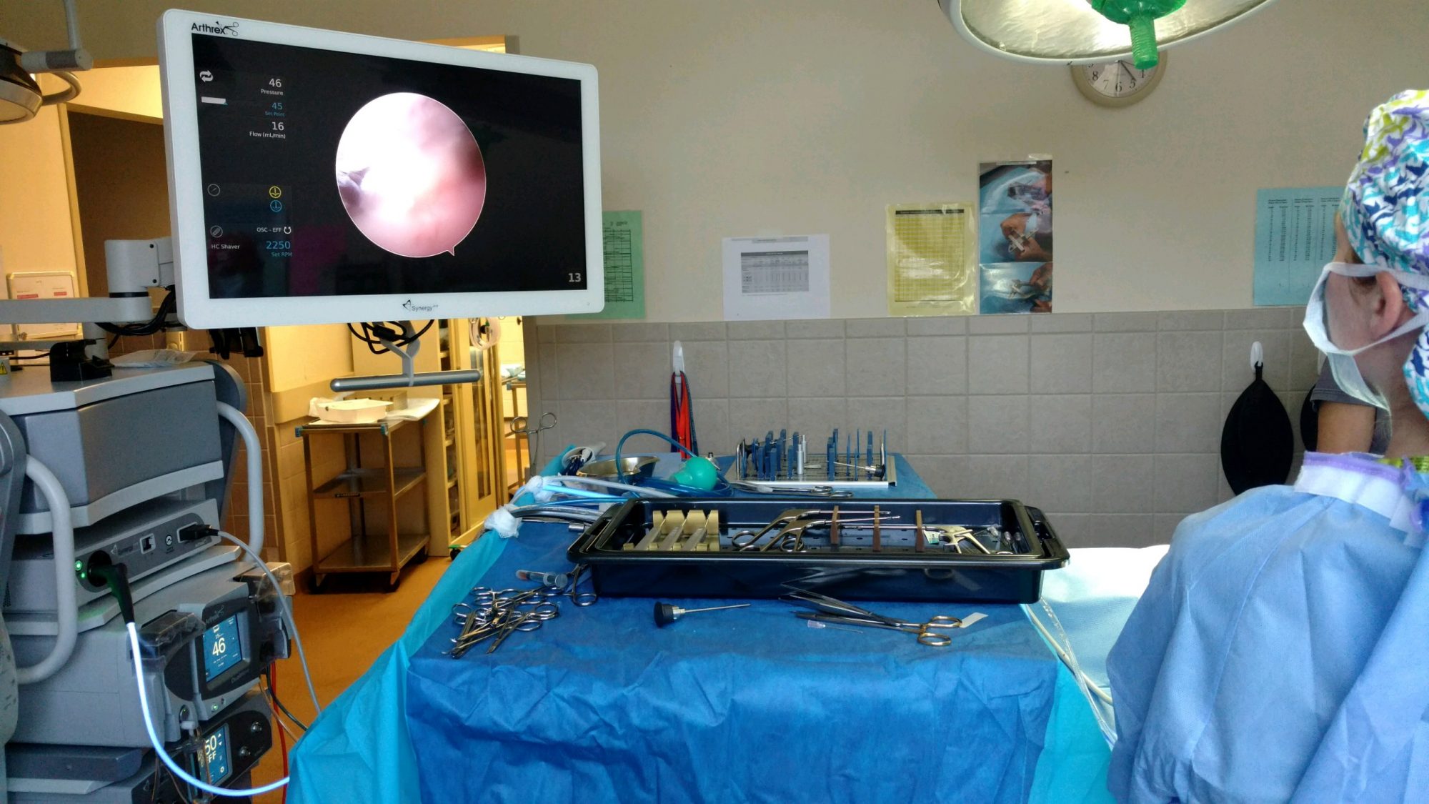 stifle arthroscopy