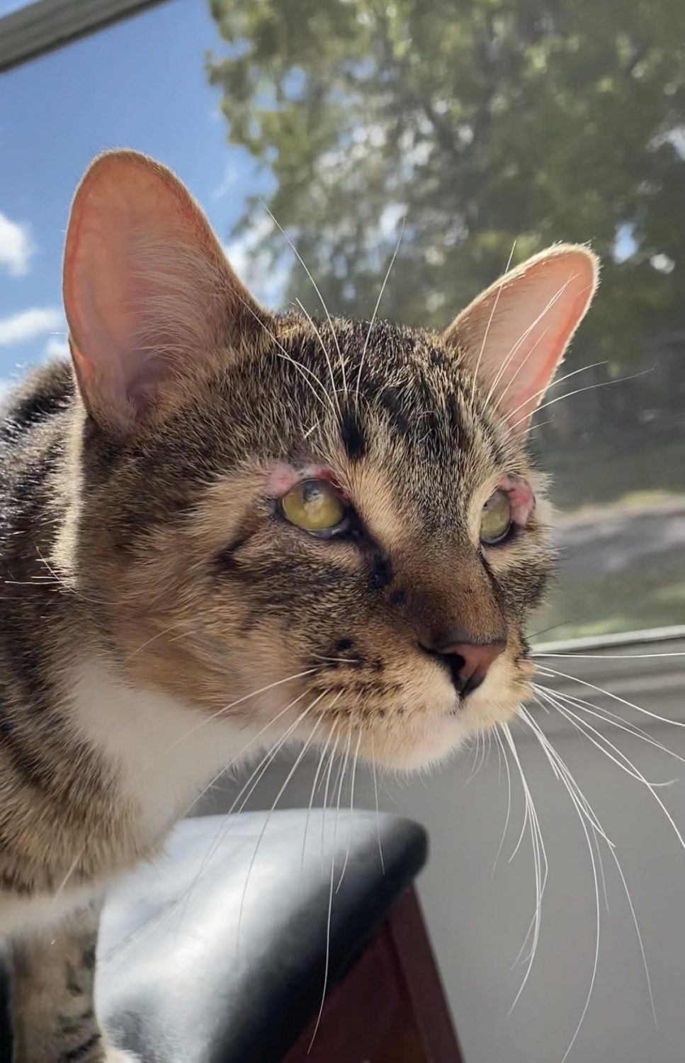 Eyelid Reconstructive Surgery Majinbou and His New Eyelids Oakland